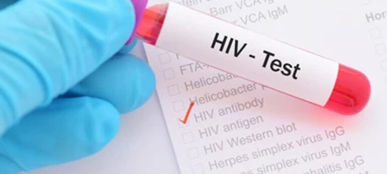HIV ස්වයං පරීක්ෂණ කට්ටල නිවසටම